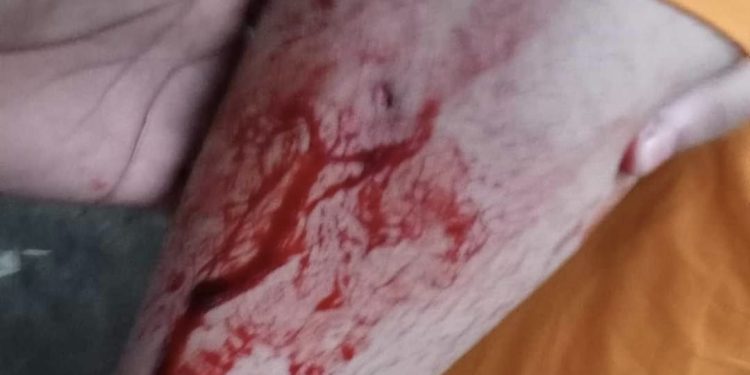 রুপগঞ্জে আবারও রফিক বাহিনীর হামলা
